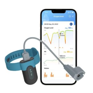 Viatom SleepU Pulsoximeter Handgele...