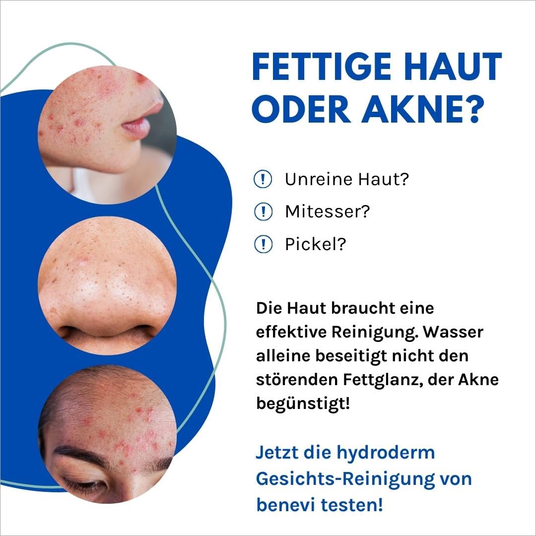 benevi hydroderm Gesichtsreiniger 125 ml für unreine und zu Akne neigende Haut, auch begleitend zur Aknetherapie, reinigt sanft und beseitigt gleichzeitig effektiv störenden Fettglanz – Bild 3