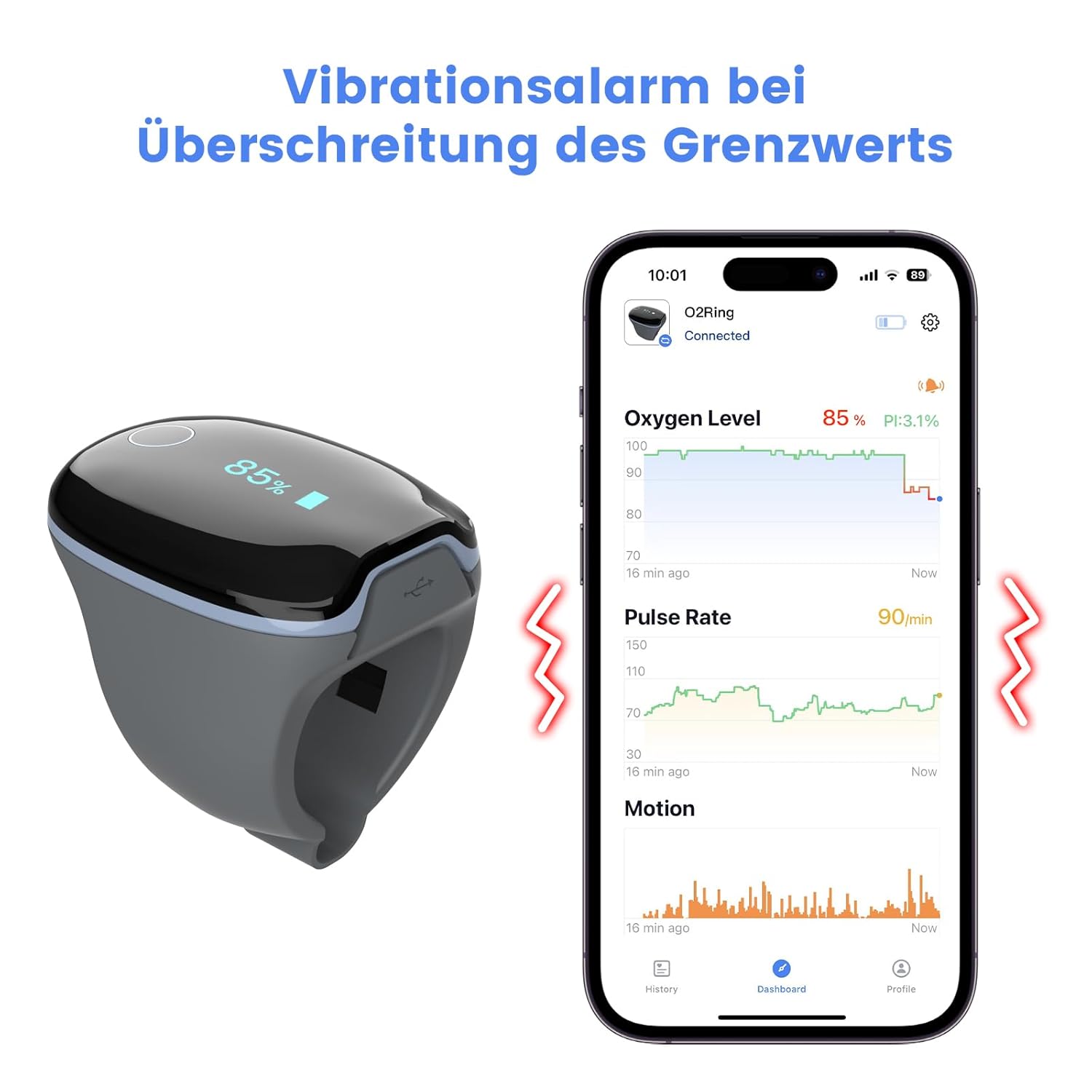 Wellue O2 Ring Bluetooth-Pulsoximeter mit Alarm, Sauerstoffsättigungsmessgerät mit kontinuierlicher Überwachung, Schlafoximeter für Blutsauerstoff und Herzfrequenz, professionelle App und Berichte – Bild 4