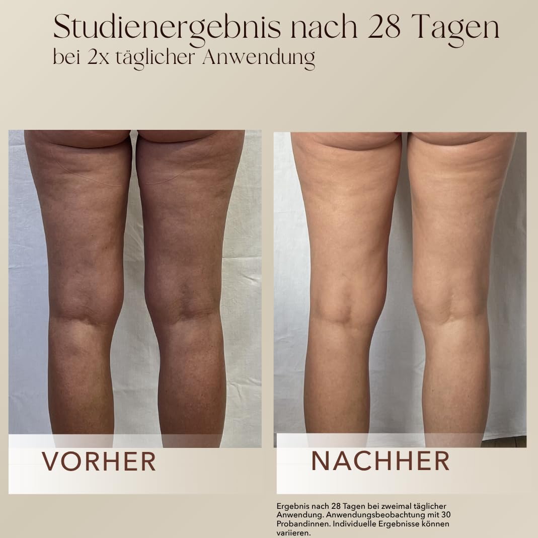 mellow NOIR Body Contour Cream 200 ml – Körpercreme gegen Cellulite und schlaffe Haut – für straffe Konturen an Bauch, Beinen und Oberarmen – zieht schnell ein, ohne zu fetten – Naturkosmetik – vegan – Bild 7