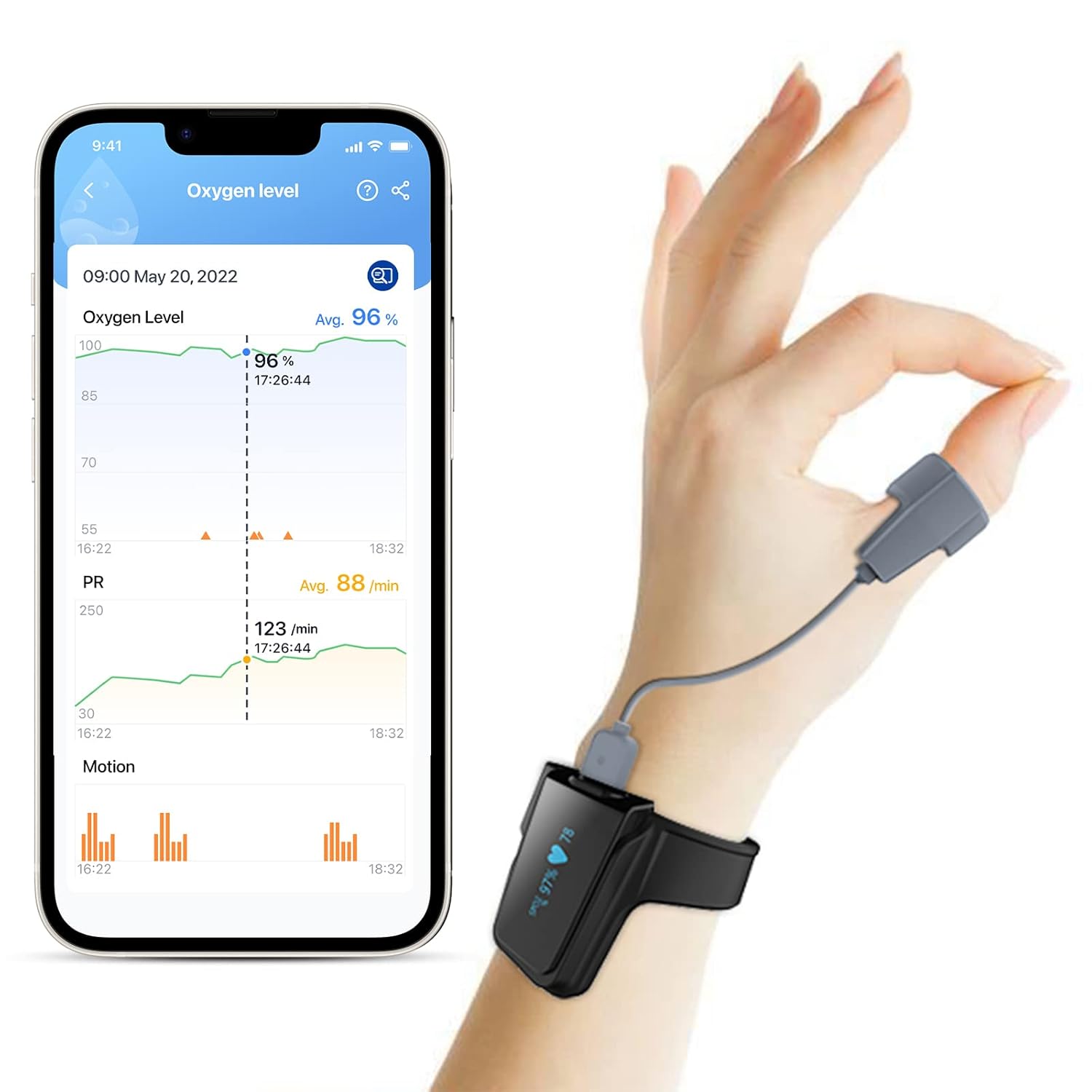 ViATOM Pulsoximeter mit Bluetooth, Sauerstoffsättigungsmessgerät für Finger und Handgelenk, tragbarer Schlafmonitor, Blutsauerstoffmessgerät, Finger mit professioneller App und PC-Bericht