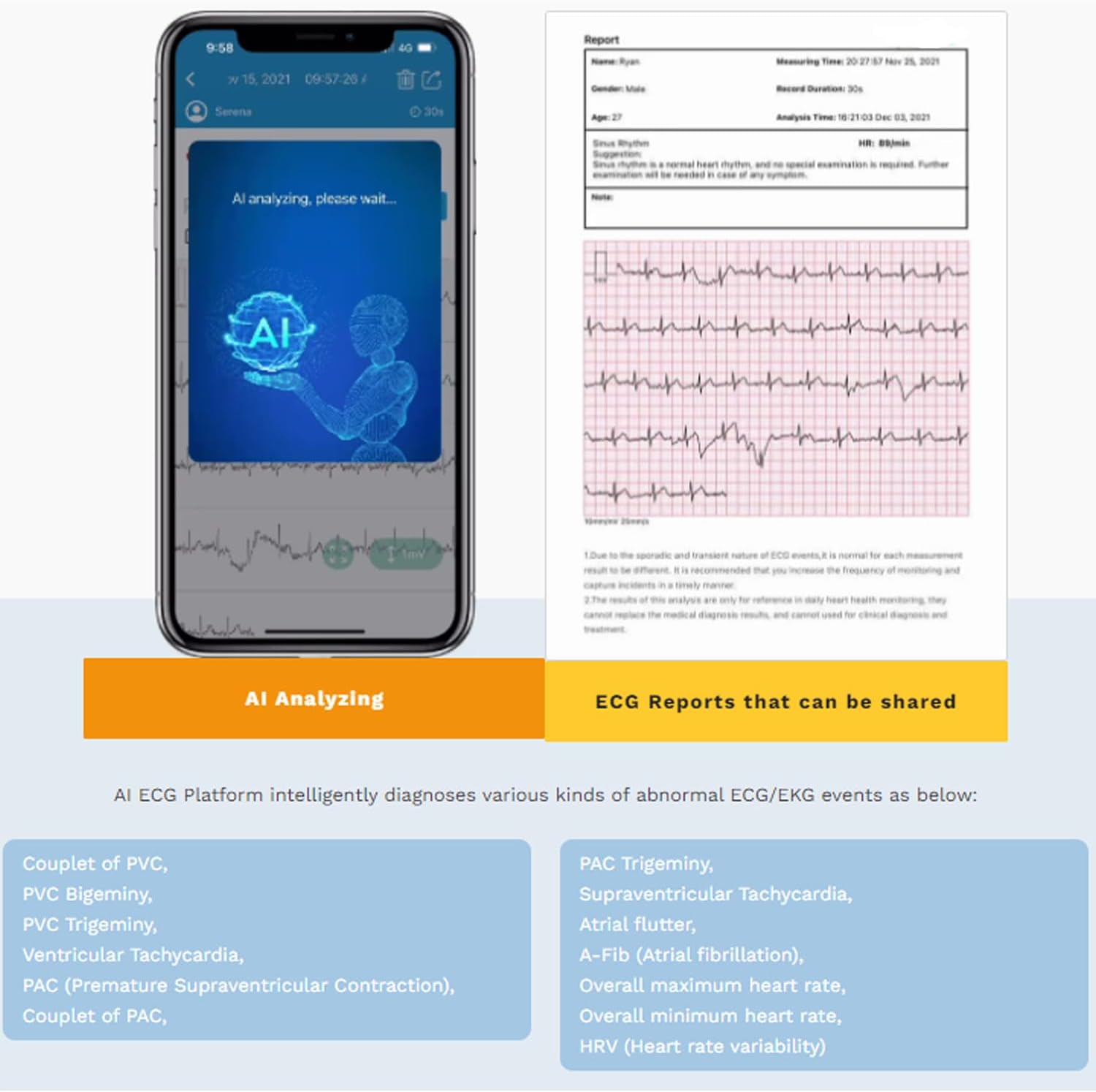 CheckMe Armfit Plus Blutdruckmessgerät Oberarm Bluetooth mit EKG, Analyse des EKG-Berichts, 30S-Messung von Blutdruck, EKG, Herzfrequenz, Multi-User-Management, Blutdruckmessgerät mit App für Android/iOS – Bild 5