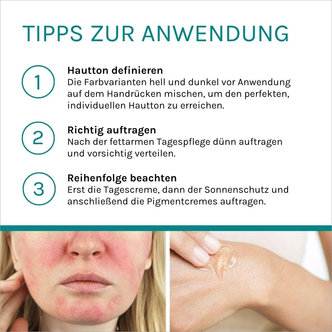 Benevi Pigment Cream 20 ml zum gezielten Abdecken von Rötungen, Pickeln, Unreinheiten oder als Make-up-Ersatz. Kaschiert zuverlässig erweiterte und rote Äderchen bei Couperose und Rosacea (leicht) – Bild 7