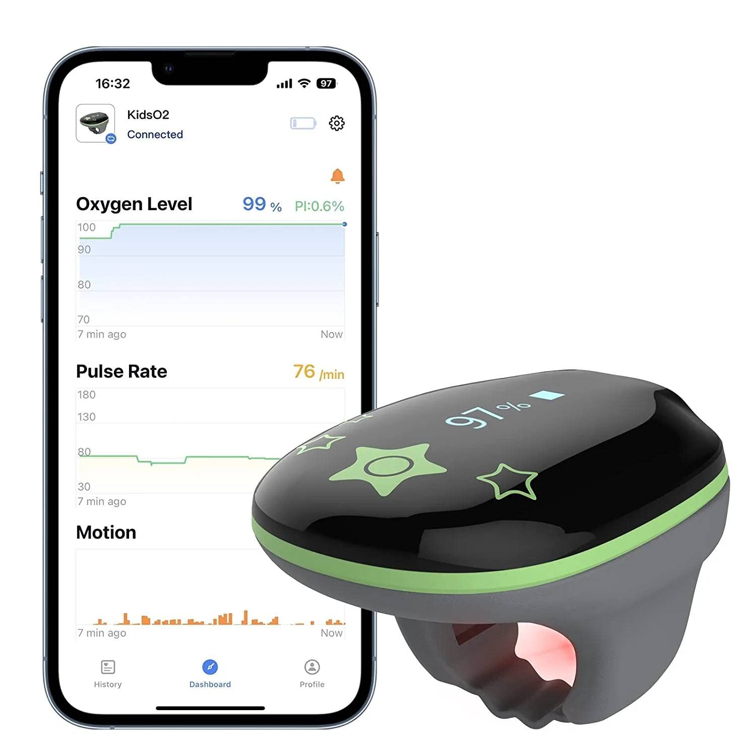ViATOM Pulsoximeter für Kinder, Pulsoximeter für Kinder, Sauerstoffmessgerät, Sauerstoffsättigungsmessgerät, SpO2- und Pulsmessung, Blutsauerstoffgehalt mit Audio-Erinnerung in App und Gerät, Bluetooth