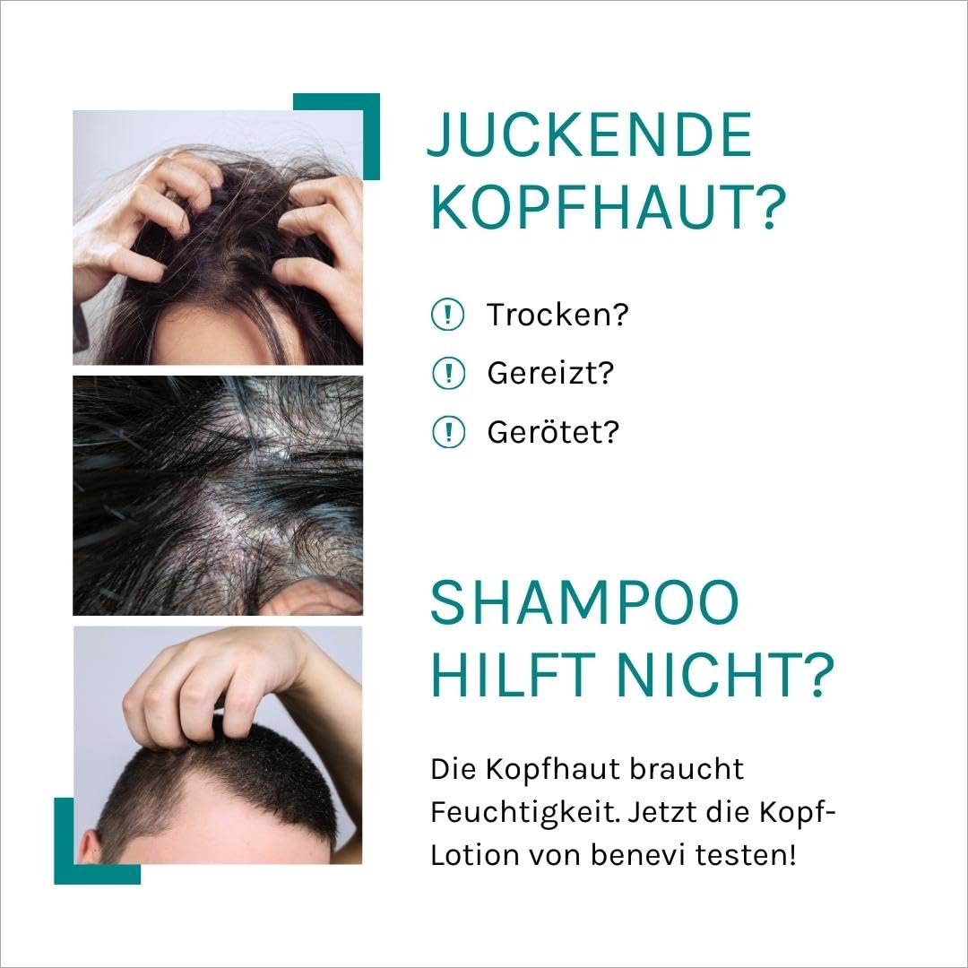 benevi Neutral Head Lotion 50 ml – Feuchtigkeitscreme für trockene, juckende, schuppige, gerötete Kopfhaut – Bild 3