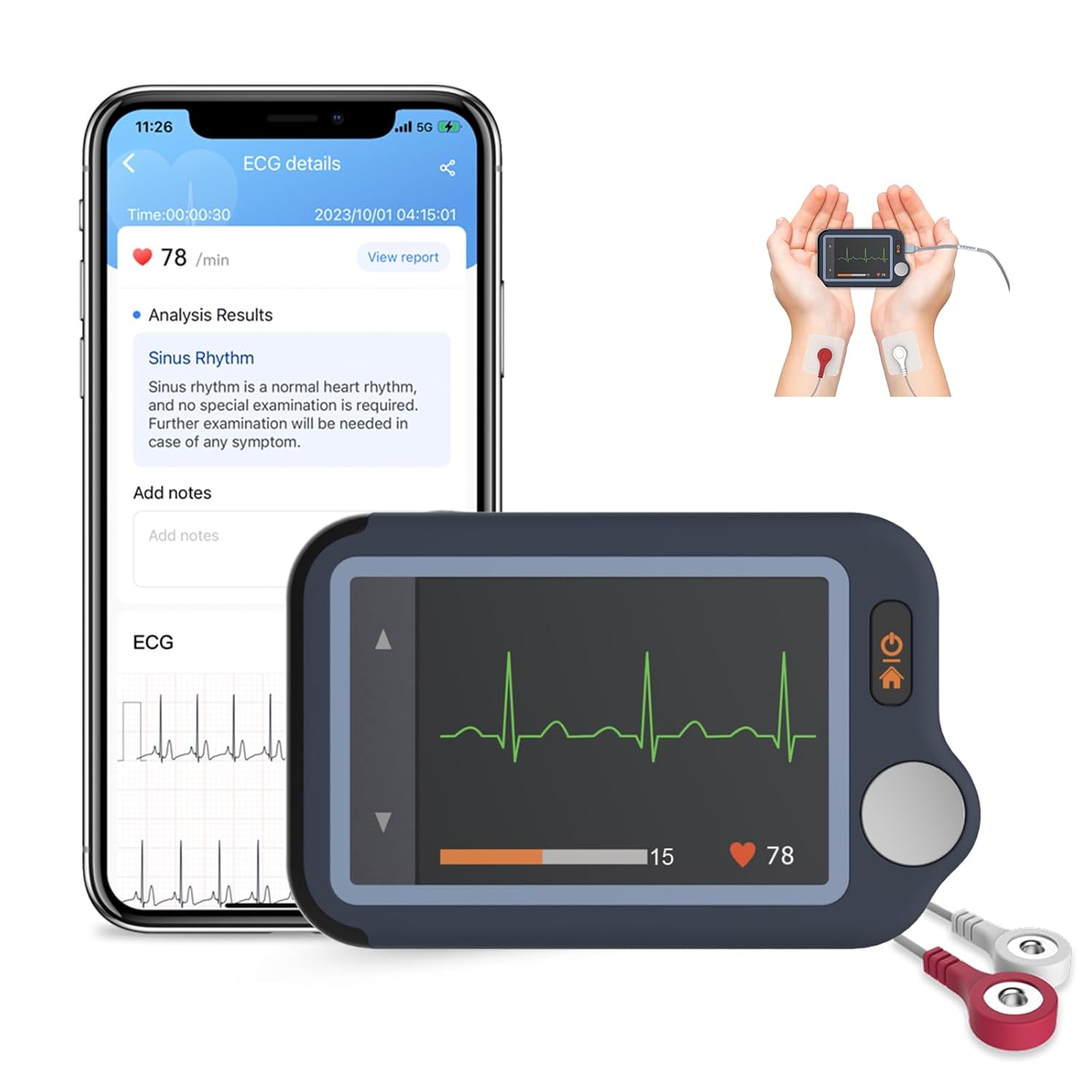 CheckMe EKG-Gerät für Zuhause, 30s/60s/5min Bluetooth-EKG-Monitor mit EKG-Analysebericht, kompatibel mit iOS & Android, Mac & Windows, Multi-User-Datenverwaltung