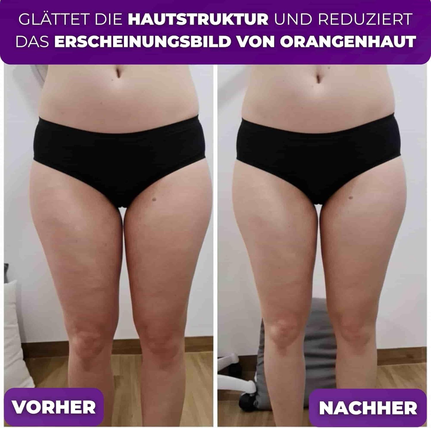 Tuuli Accessories Anti-Cellulite-Massageroller mit Griff, Maderotherapie aus Holz, für Beine, Oberschenkel, Bauch, Körper – Bild 5