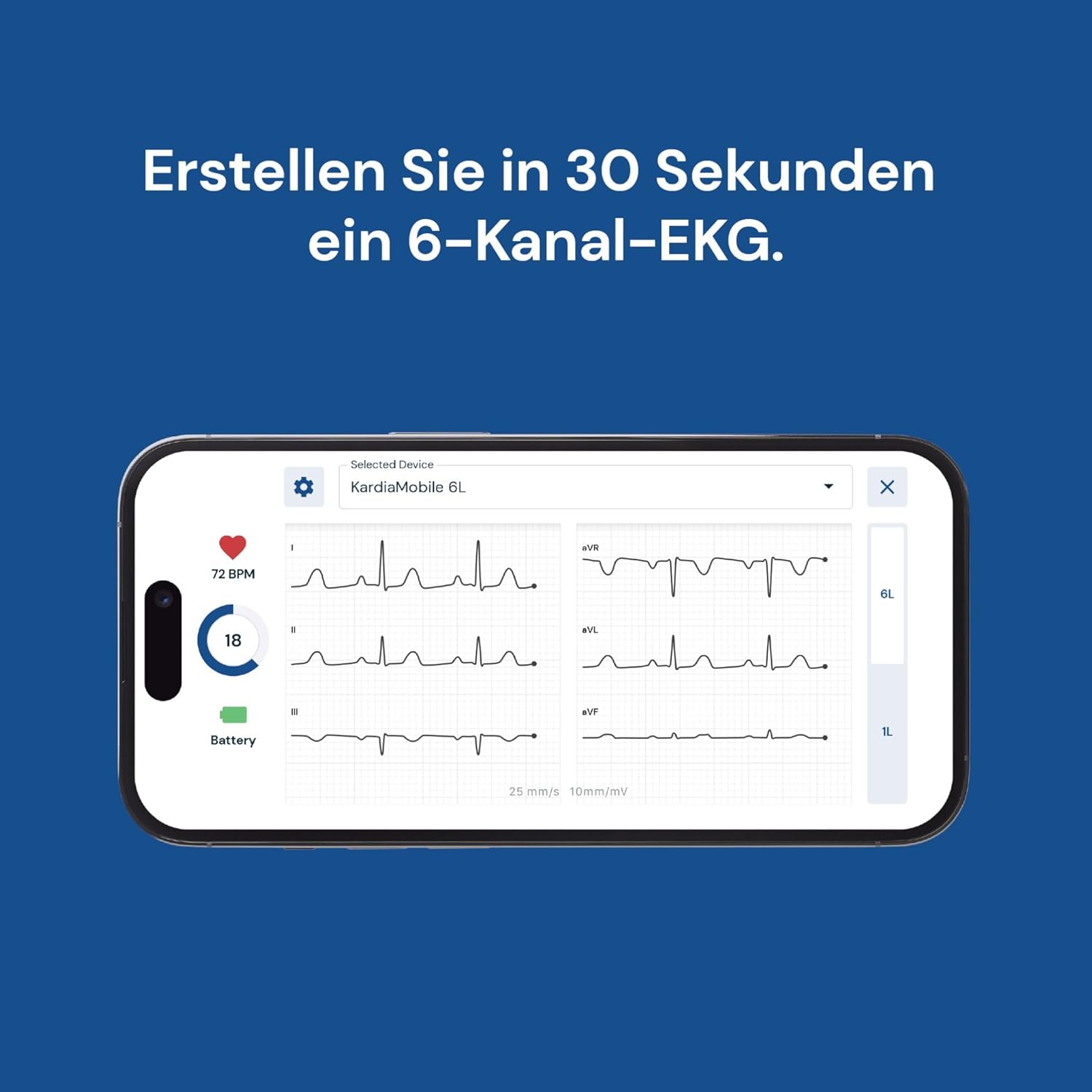 Persönlicher 6-Kanal-EKG-Herzfrequenzmonitor von KardiaMobile – sechs Ansichten des Herzens, erkennt Vorhofflimmern, schnelle Ergebnisse – Bild 9