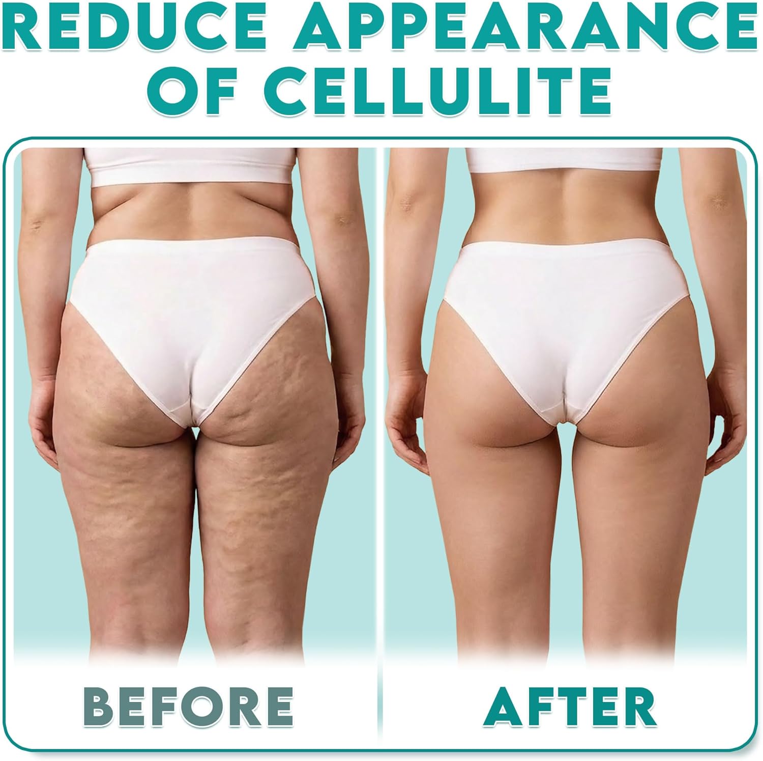 MyoRelease Lymphdrainage-Massagegerät + Narbengewebe-Massagegerät für Bauch, Oberschenkel, Rücken und Gesäß – Hilft, das Auftreten von Cellulite zu reduzieren – Grün – von Cozlow – Bild 8