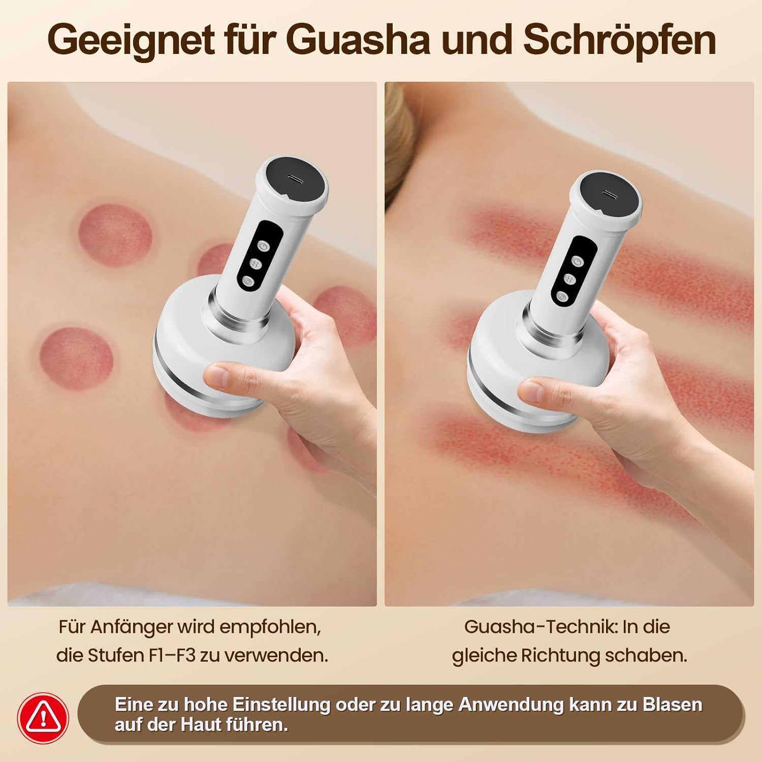 Cellulite Massagegerät Lymphatic Drainage - Schröpfgerät Elektrisch mit 30 Gängen,Verbesserung des Hautzustandes,Vakuum Massagegerät für Rücken, Taille, Arme und Beine – Bild 3