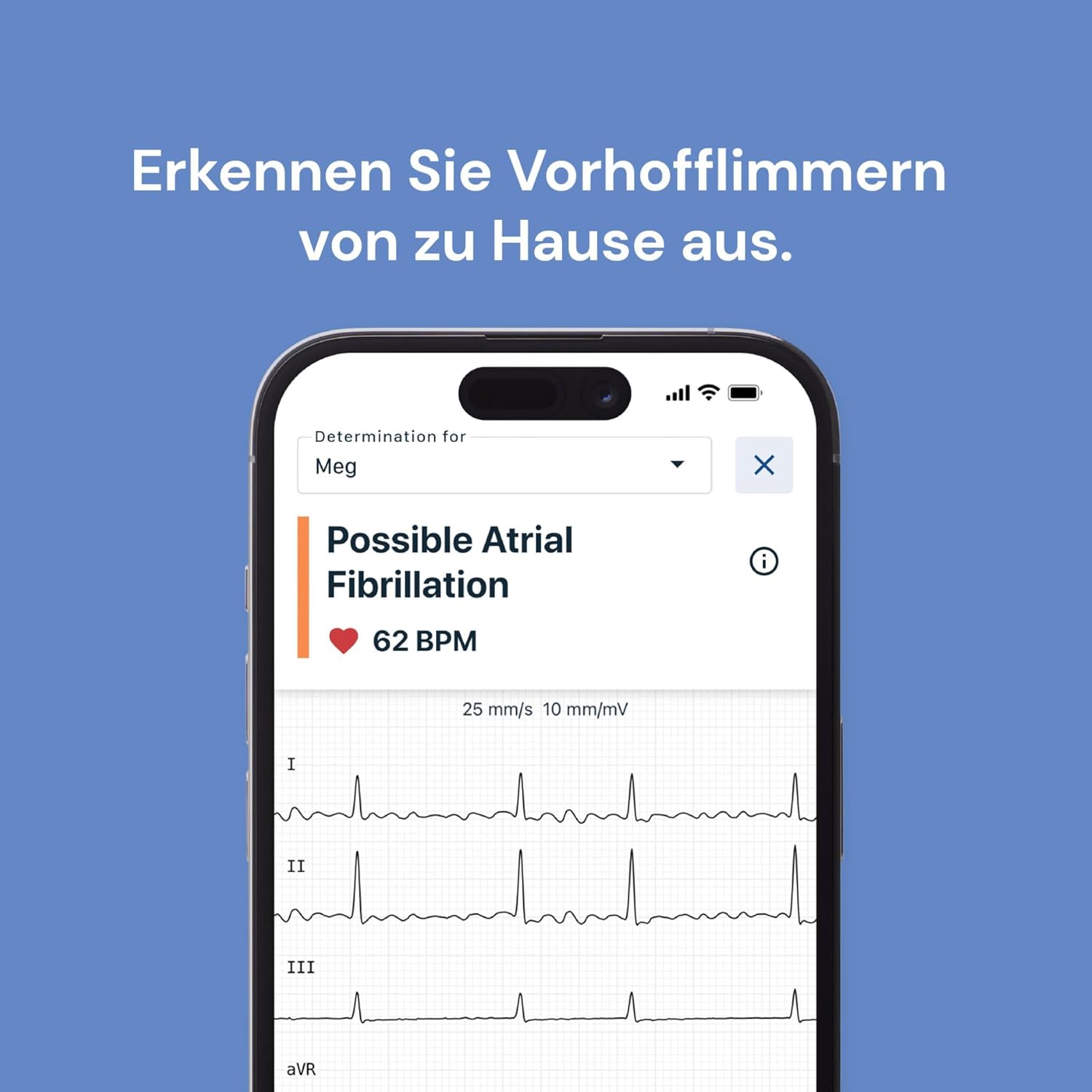 Persönlicher 6-Kanal-EKG-Herzfrequenzmonitor von KardiaMobile – sechs Ansichten des Herzens, erkennt Vorhofflimmern, schnelle Ergebnisse – Bild 5
