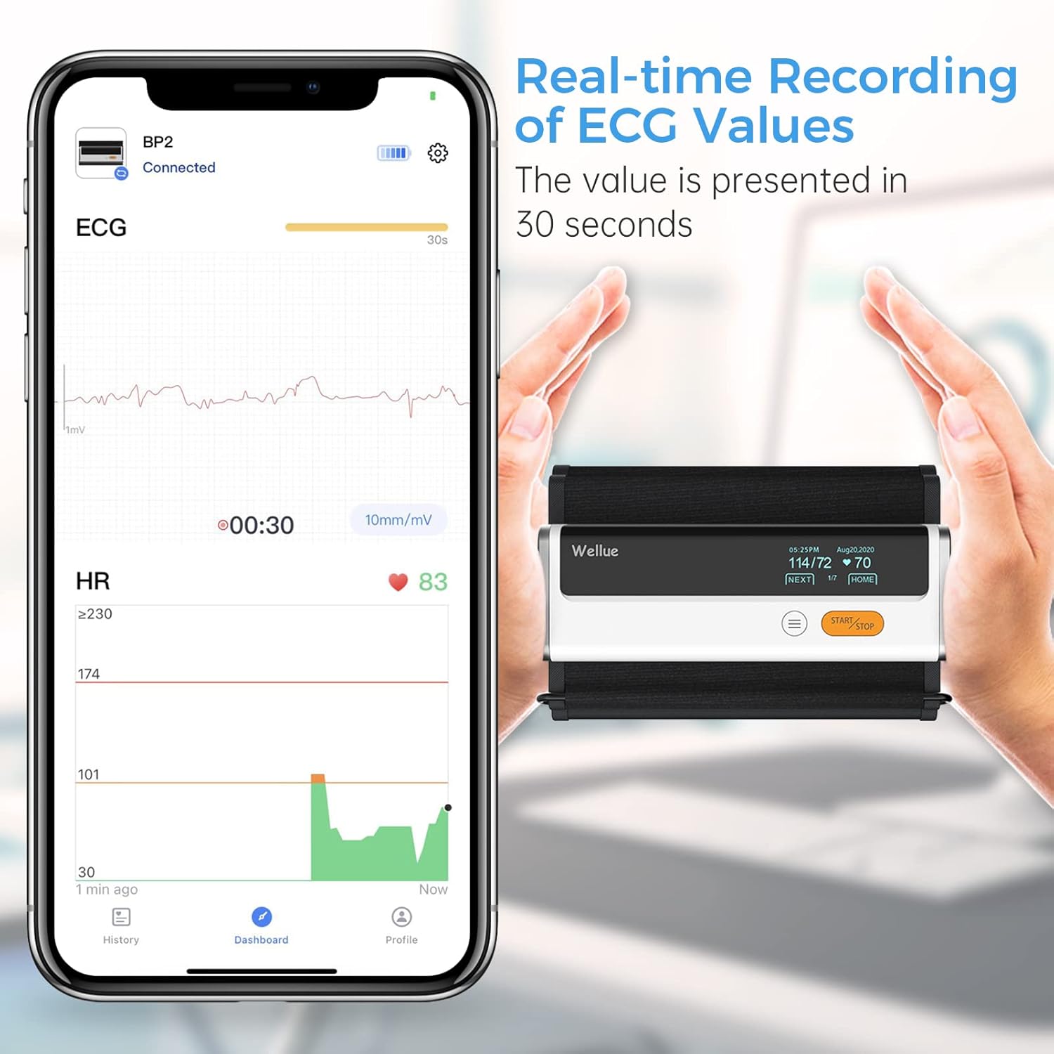 Wellue Armfit Plus Blutdruckmessgerät mit EKG-Funktion, Bluetooth-Oberarm-Blutdruckmessgerät für den Heimgebrauch, große Blutdruckmanschette, kostenlose App für iOS & Android – Bild 3