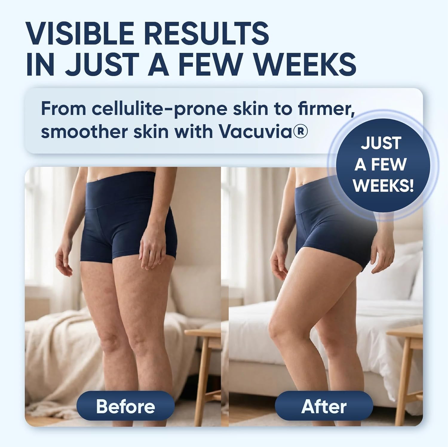 Vacuvia 4-in-1-Cellulite-Massagegerät – straffere Haut, Tiefenmassage, bessere Durchblutung und Wärme – ideal für den Heimgebrauch – Bild 6