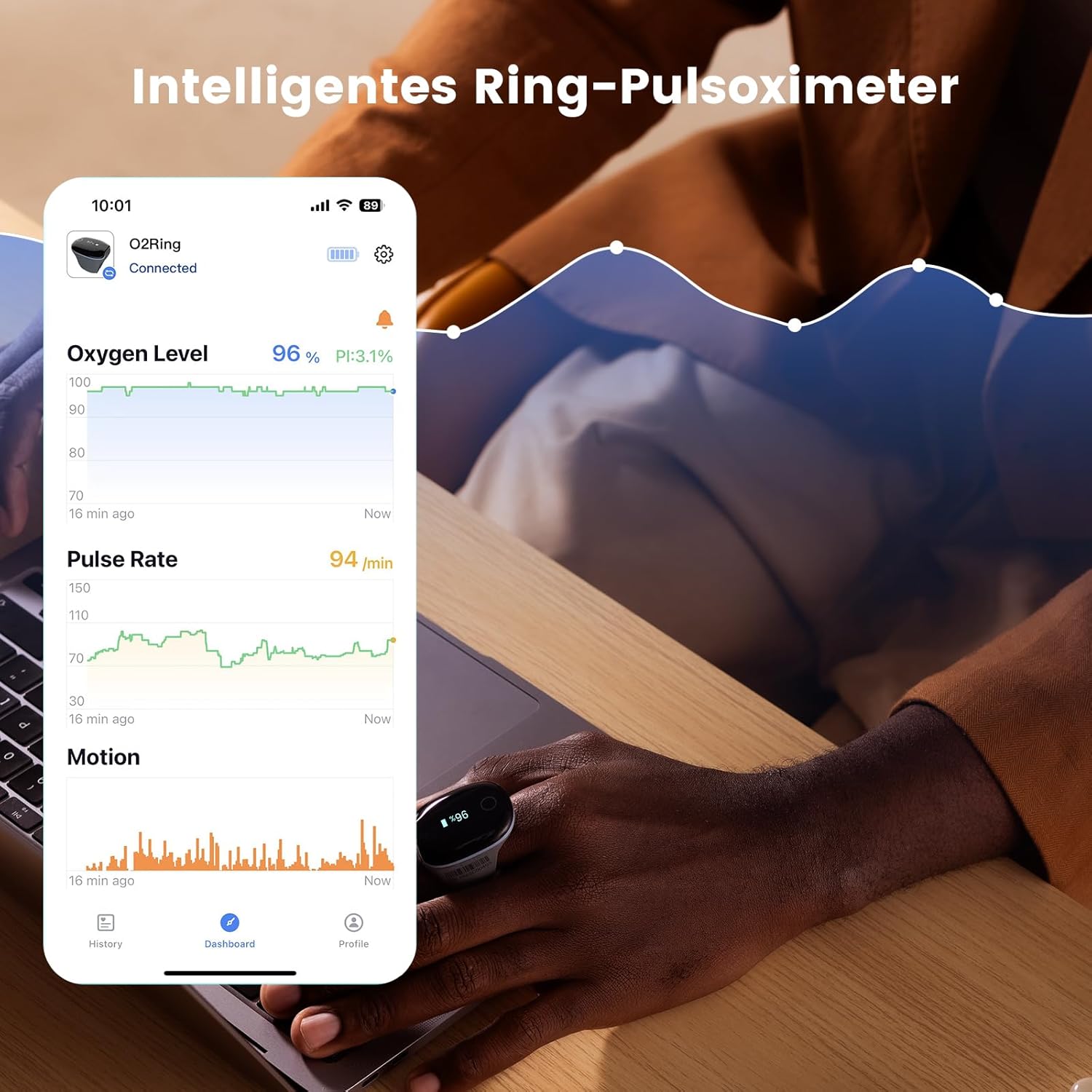 Wellue O2 Ring Bluetooth-Pulsoximeter mit Alarm, Sauerstoffsättigungsmessgerät mit kontinuierlicher Überwachung, Schlafoximeter für Blutsauerstoff und Herzfrequenz, professionelle App und Berichte – Bild 2