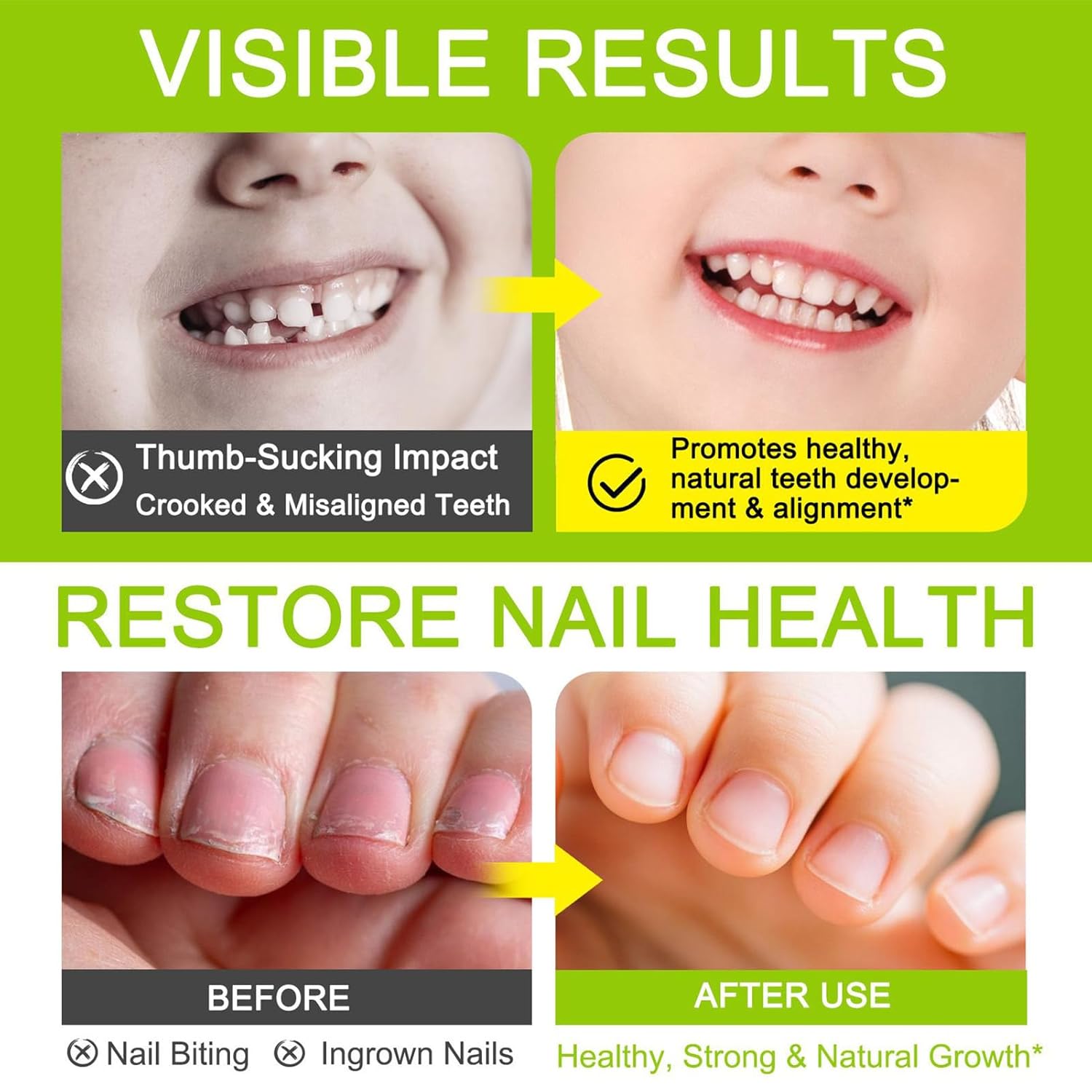Stoppen Sie Nagelbeißen für Kinder, 7 ml, verhindert Fingernägel, Präventionsstift, natürliche Gesundheitsvorsorge, Saugengewohnheiten für Nägel, Fingernägel, Männer, Frauen, Erwachsene – Bild 4